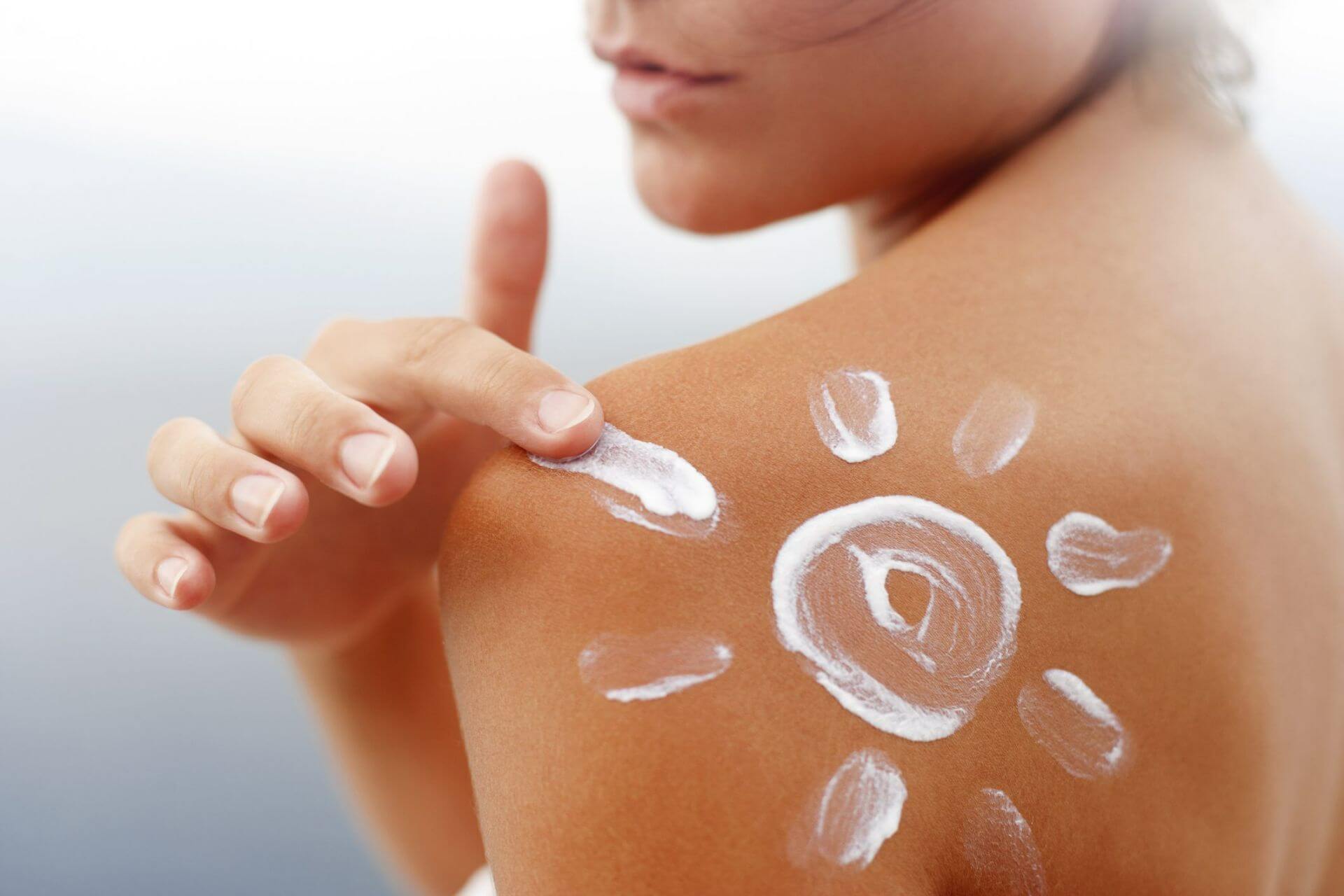 Top 10 tips for treating sunburn